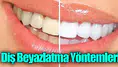 Diş Beyazlatma Yöntemleri