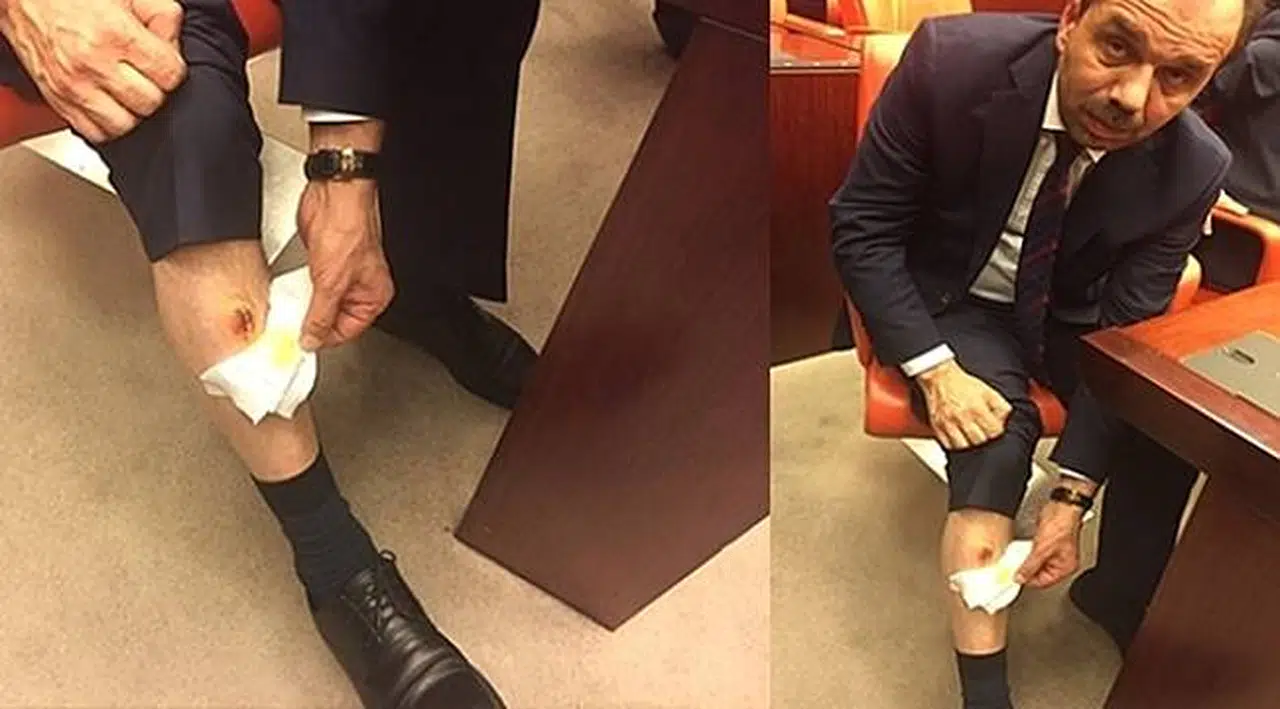 AK Parti'li Balta: Bacağımı CHP'li Vekil Isırdı