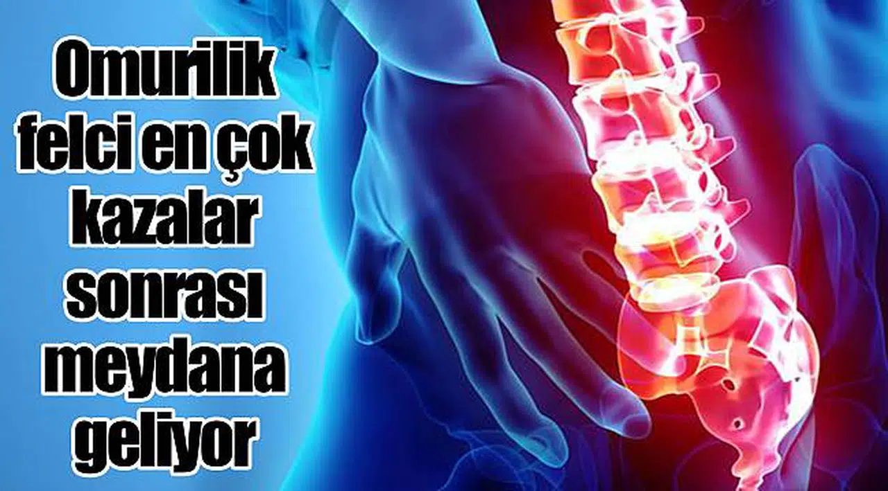 Omurilik felci en çok kazalar sonrası meydana geliyor