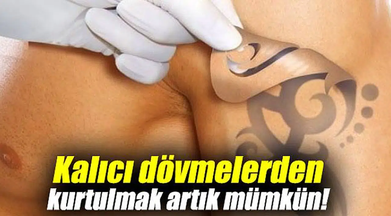Kalıcı dövmelerden kurtulmak artık mümkün!