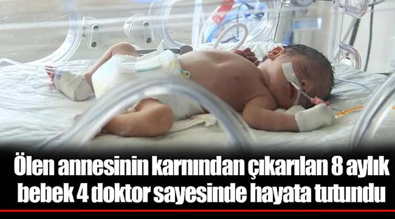 Ölen annesinin karnından çıkarılan 8 aylık bebek 4 doktor sayesinde hayata tutundu