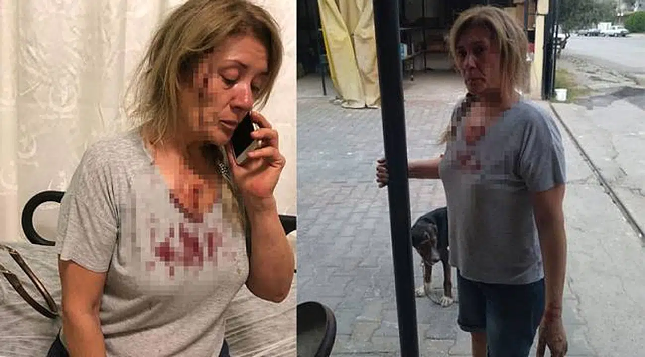 Balıksir'de köpeklerini gezdirirken dehşeti yaşadı!