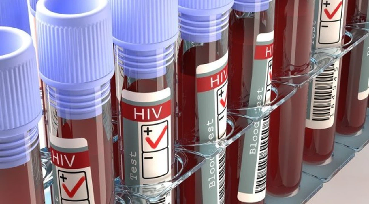 AIDS nedir? AIDS belirtileri nelerdir? AIDS nasıl bulaşır?