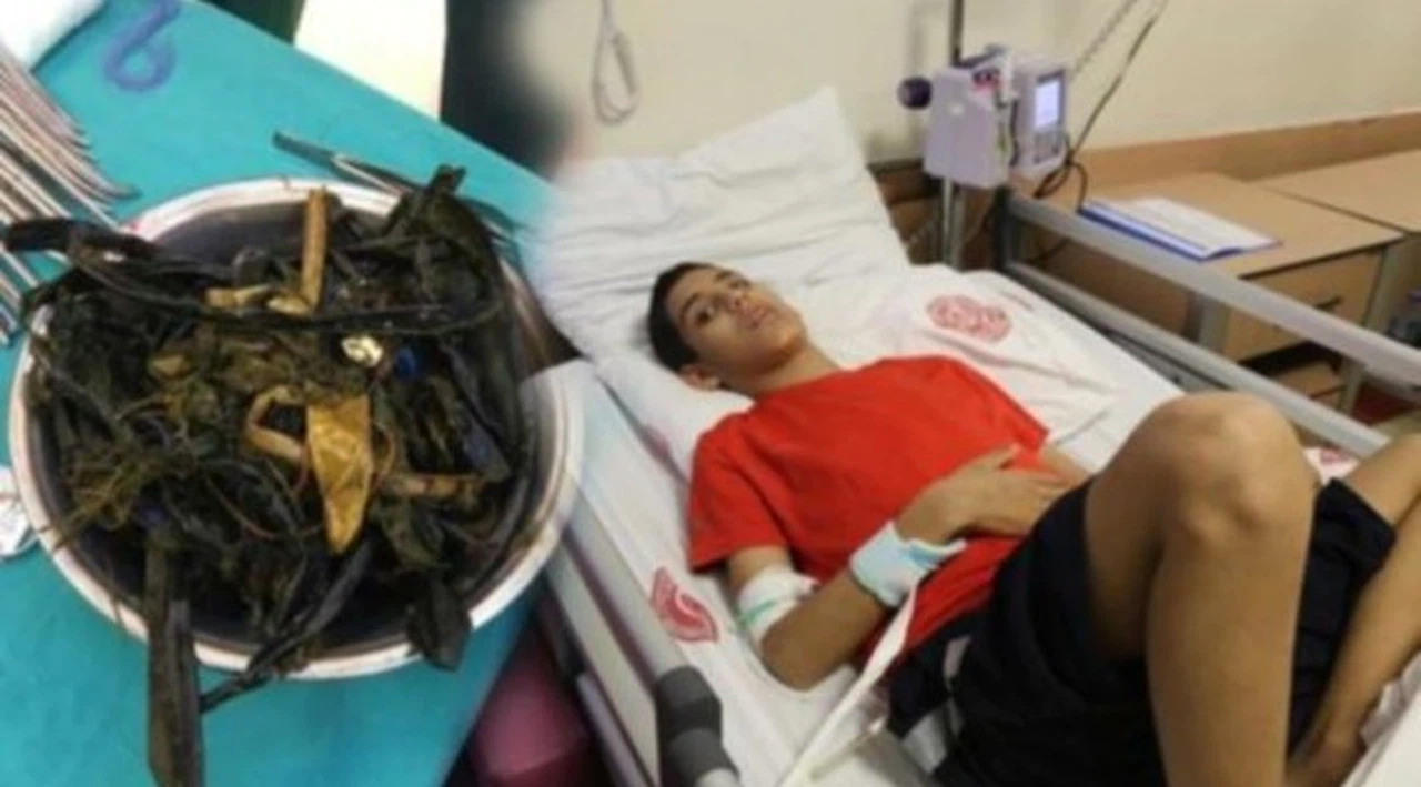 Tam 2 kilo! Karnından çıktı! Doktorlar şaşkın: İlk kez karşılaşıyoruz