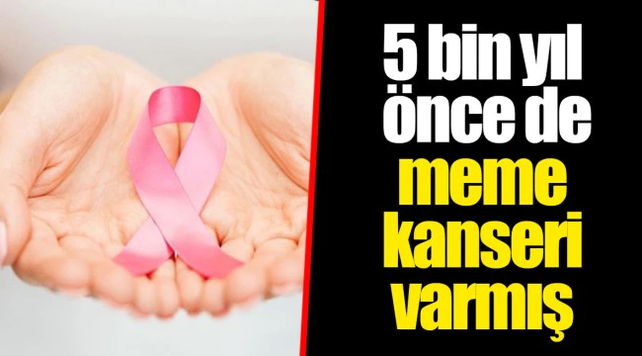 5 bin yıl önce de meme kanseri varmış