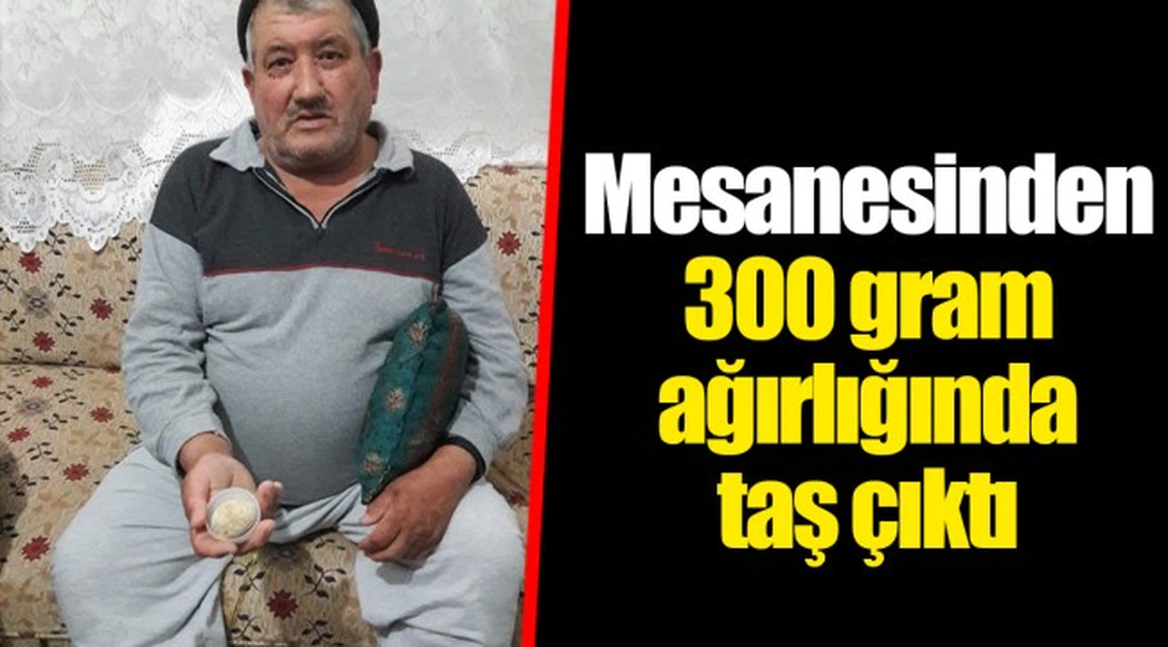 Mesanesinden 300 gram ağırlığında taş çıktı