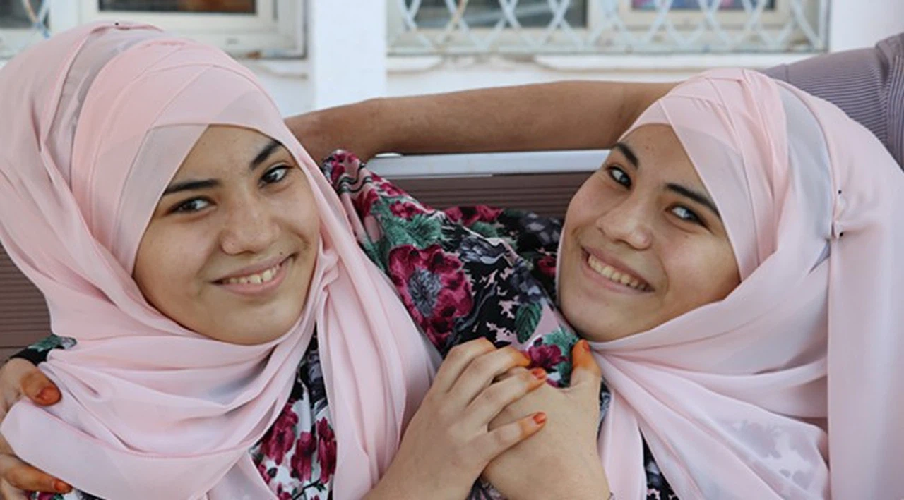 Siyam ikizlerinin üniversite hayali gerçek oluyor