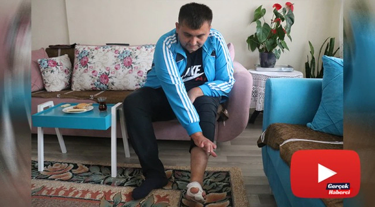 İş kazasında kaybettiği el parmaklarının yerine ayak parmakları nakledildi