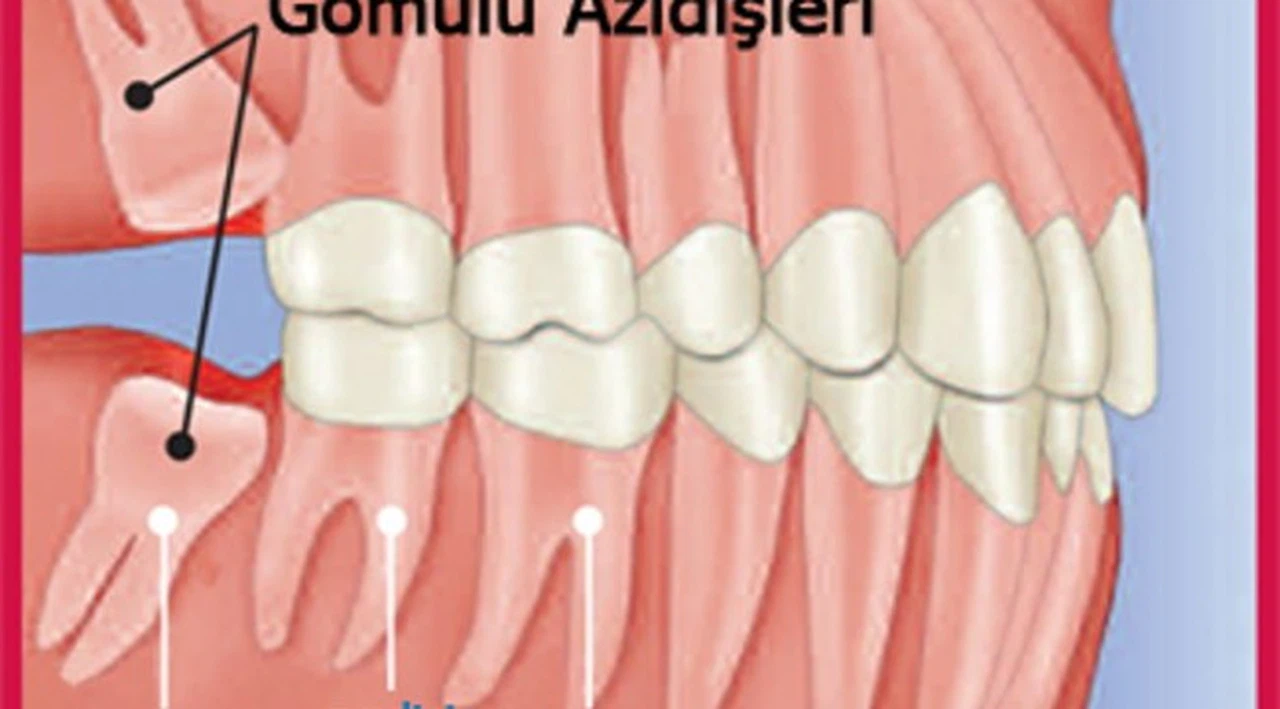 20 yaş dişlere dikkat