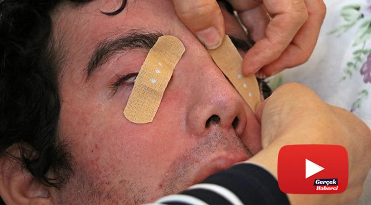 6 yıldır gözlerini kırpamıyor, kan çanağına dönen gözleri bantla kapatılıyor