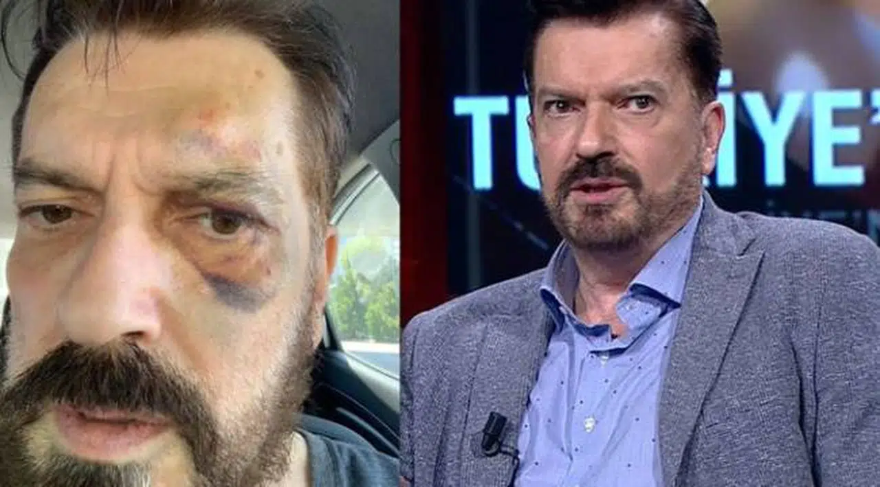 Hakan Bayrakçı uğradığı saldırıyı anlattı: "Yiyorsa tek gel dedim, 5 kişi geldiler..."
