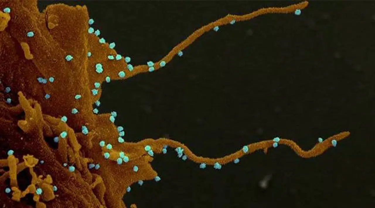 Sars-Cov-2 virüsü, enfekte ettiği hücrelerden spagetti benzeri kollar çıkarıp hücreden hücreye geçiyor