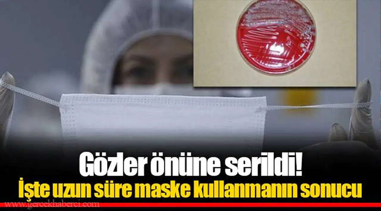 Gözler önüne serildi! İşte uzun süre maske kullanmanın sonucu