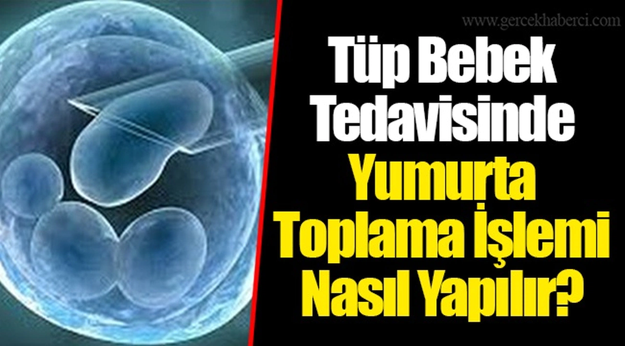 Tüp Bebek Tedavisinde Yumurta Toplama İşlemi Nasıl Yapılır?