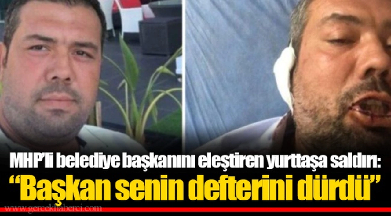 MHP’li belediye başkanını eleştiren yurttaşa saldırı: “Başkan senin defterini dürdü”