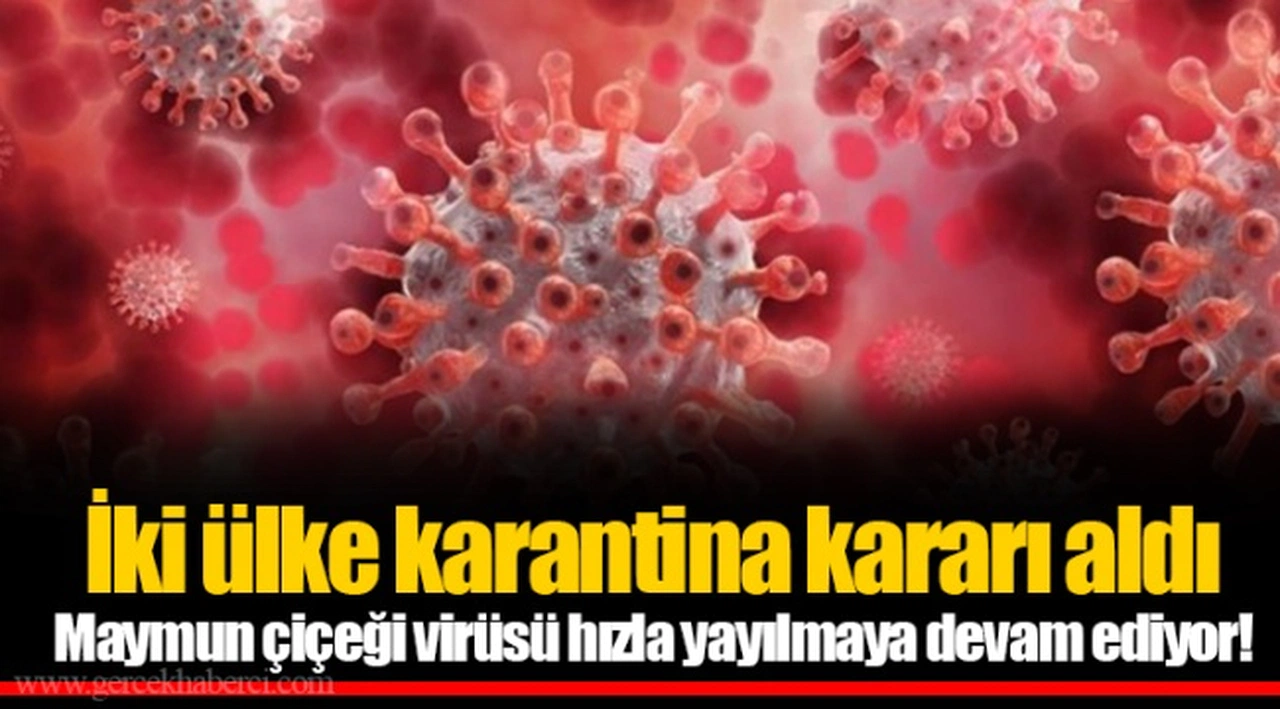 İki ülke karantina kararı aldı Maymun çiçeği virüsü hızla yayılmaya devam ediyor!