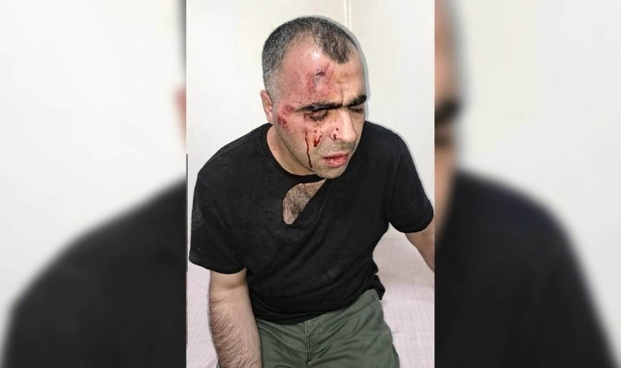 Gazeteci Sinan Aygül: Tatvan belediye başkanının korumalarının saldırısına uğradım