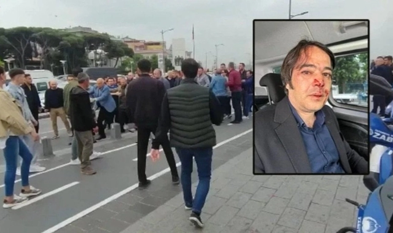İBB imar müdürünü darp eden şüpheli serbest kaldı