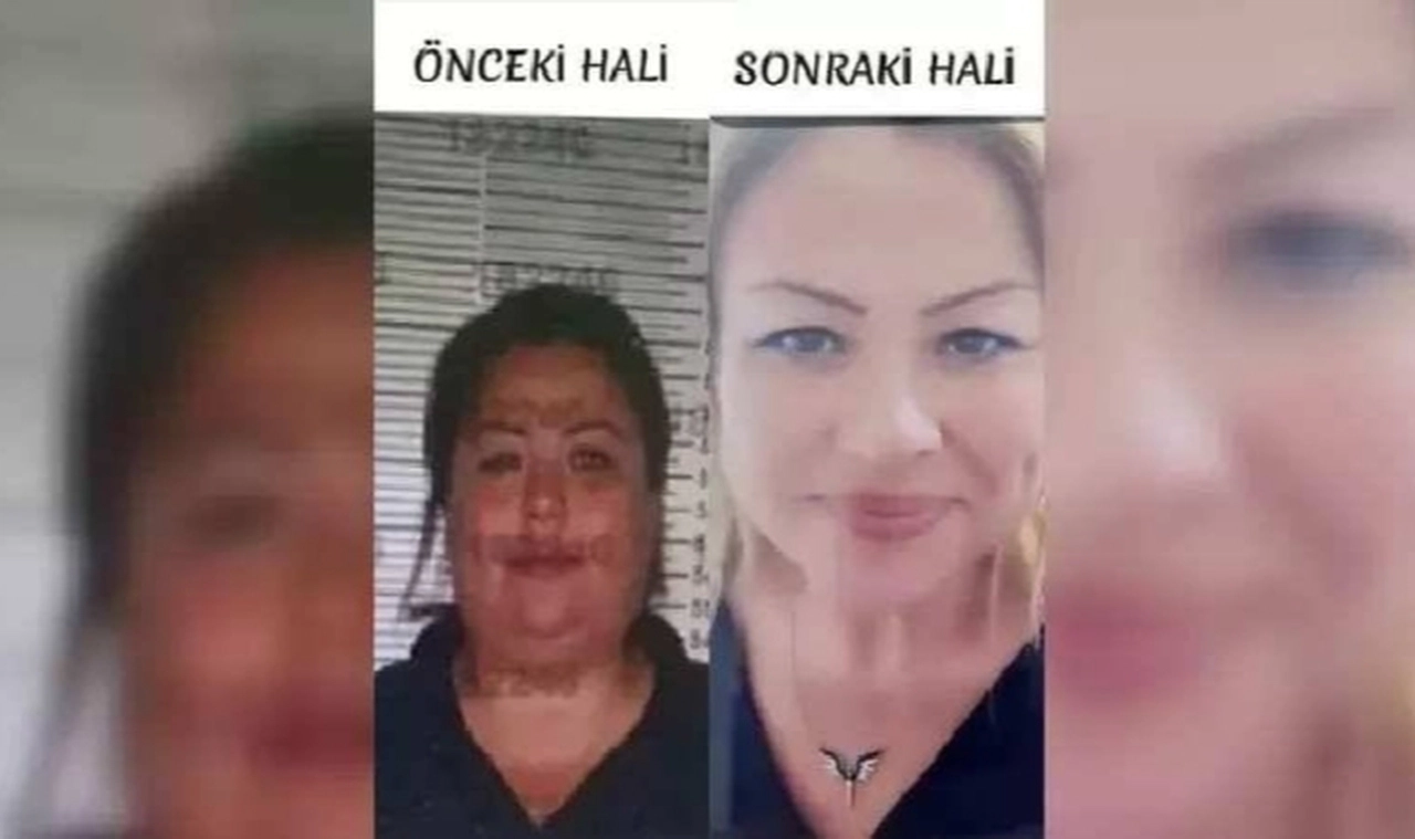 Çekleri çalıp, tekrar piyasaya süren kadın kimliğini kullandığı kardeşine benzemek için estetik yaptırmış