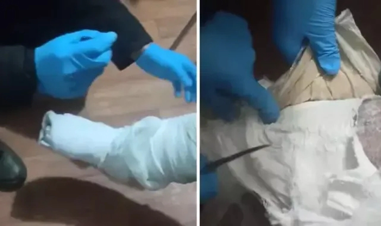 Polisin dikkatinden kaçmadı: Ayağındaki alçıdan uyuşturucu çıktı
