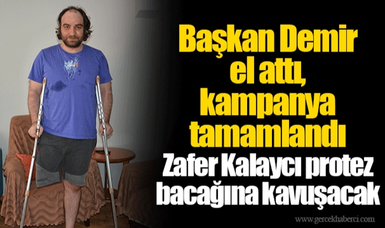 Zafer Kalaycı protez bacağına kavuşacak