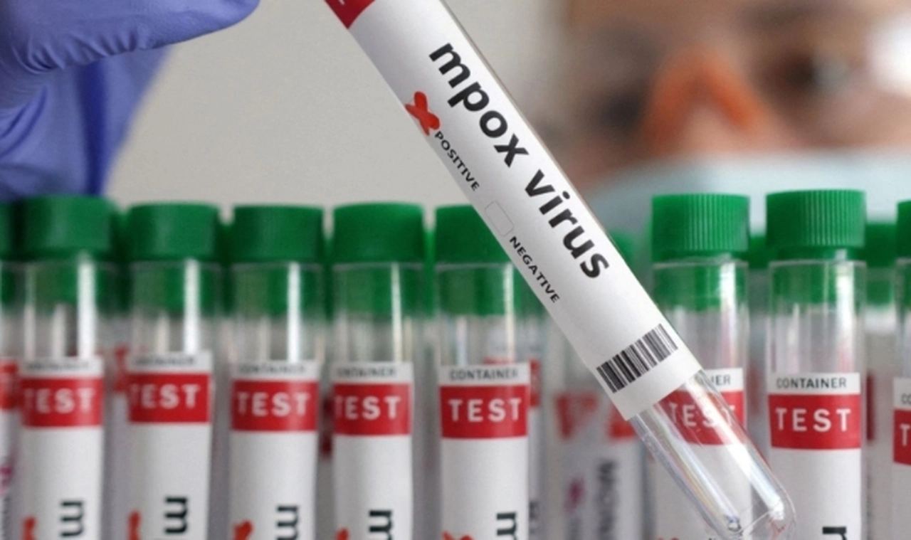 İki farklı virüs: Covid-19 ve M çiçeği arasında hangi farklar var?