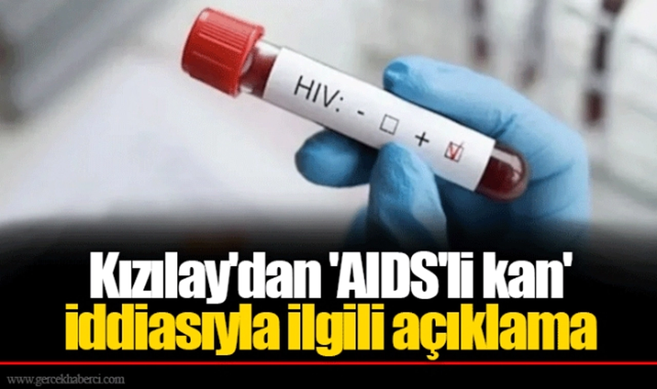 Kızılay'dan 'AIDS'li kan' iddiasıyla ilgili açıklama