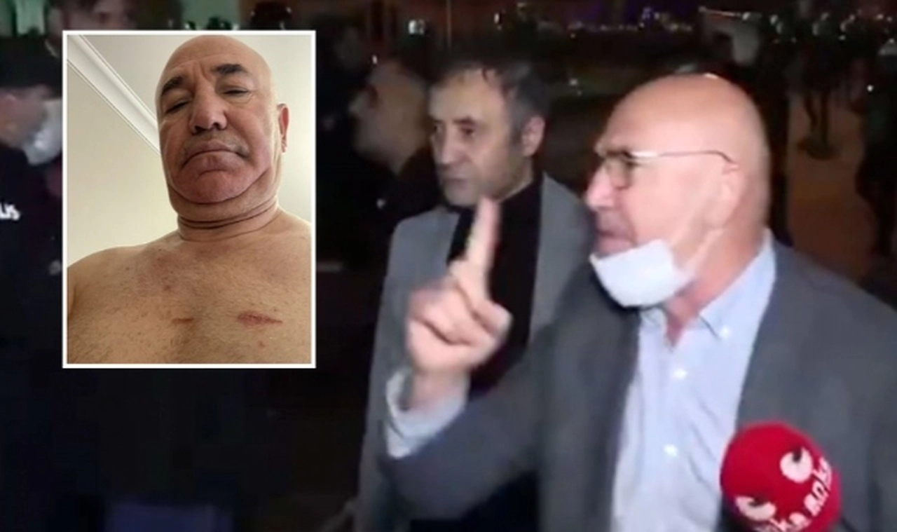 Saraçhane’de CHP’li Mahmut Tanal’a polis şiddeti: Vücudundaki darp izlerini paylaştı!
