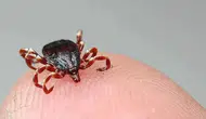 Kene ısırması sonucu KKKA şüphesiyle tedavi gören kişi hayatını kaybetti