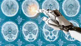 Yapay zeka doktor notlarını analiz etti: Kan şekeri normal olanlarda GLP-1 ilaçları daha hızlı etki ediyor