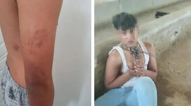 Ahırda zincirli işkence iddiası: Baba, amca ve ağabeye gözaltı