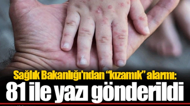 Sağlık Bakanlığı'ndan “kızamık” alarmı: 81 ile yazı gönderildi