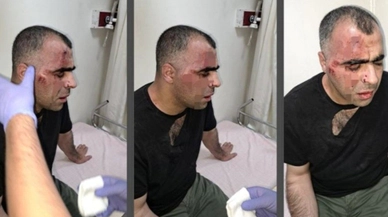 Gazeteci Sinan Aygül'e saldıran biri polis 2 koruma hakkında tahliye kararı