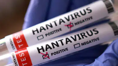 Yolcu Gemisinde Can Alan Hantavirüs: DSÖ Küresel Riski Düşük Değerlendiriyor