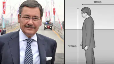 Gökçek döneminde alınan 4 milyon liralık robotun akıbeti bilinmiyor