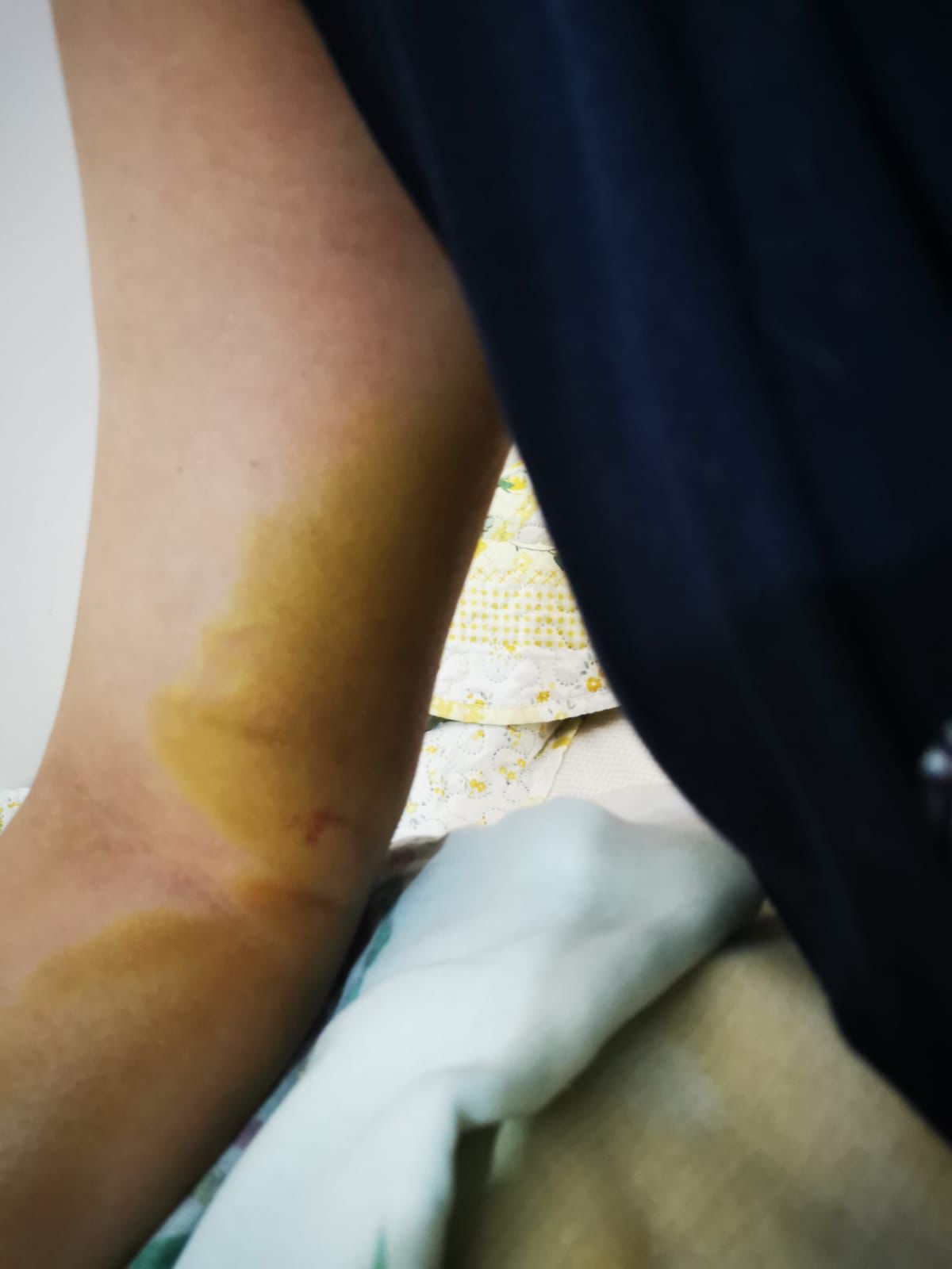 Şiddet failine ‘tahrik ve iyi hal indirimi’: “Ben bunları yaşarken o cezasız kaldı”
