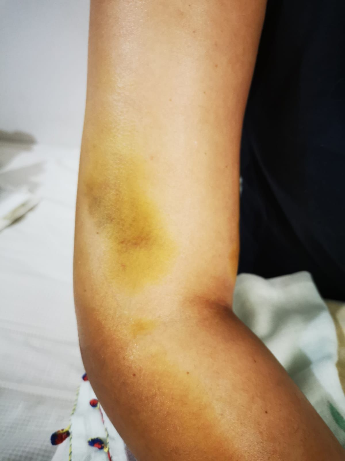 Şiddet failine ‘tahrik ve iyi hal indirimi’: “Ben bunları yaşarken o cezasız kaldı”