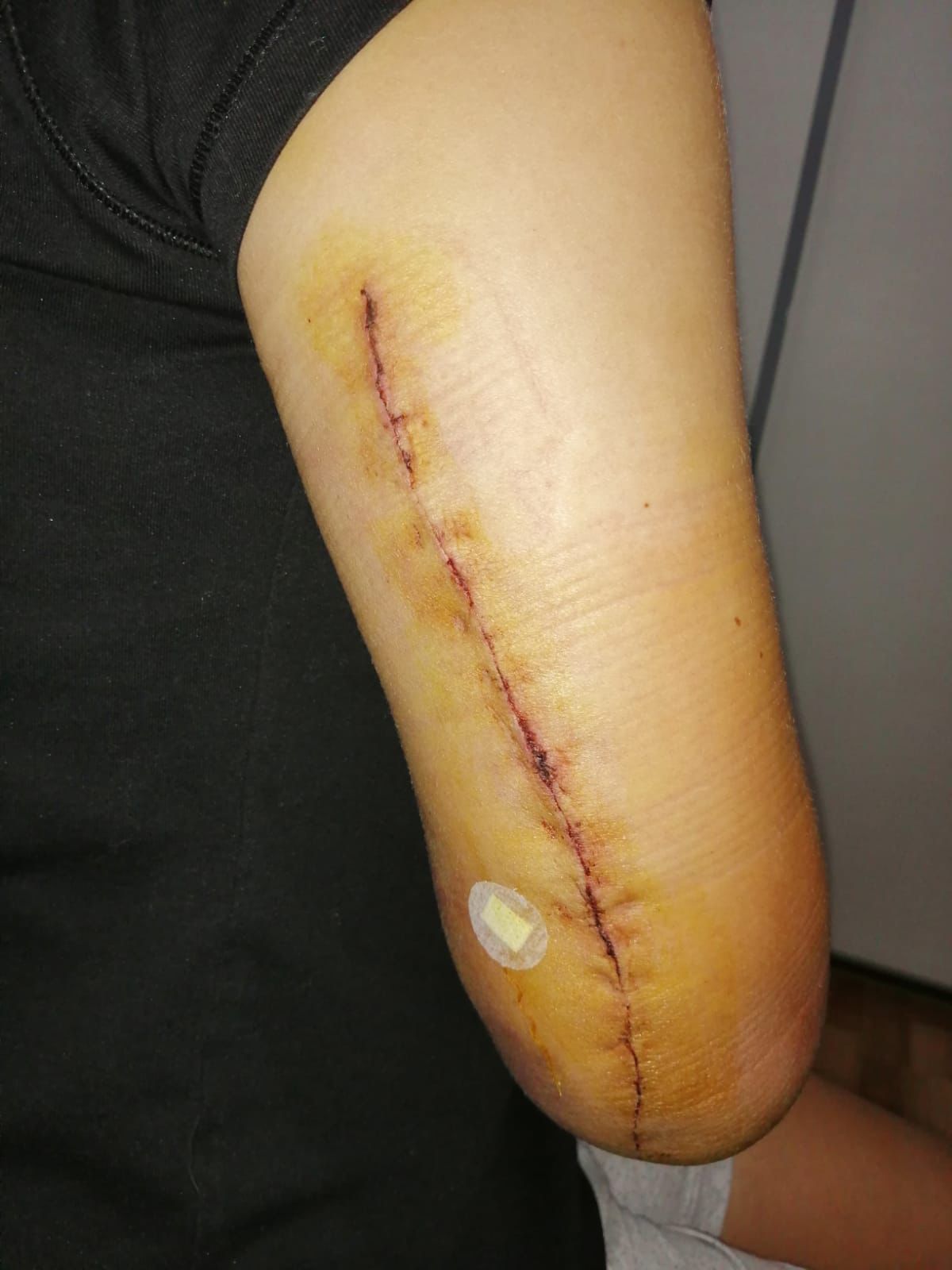 Şiddet failine ‘tahrik ve iyi hal indirimi’: “Ben bunları yaşarken o cezasız kaldı”