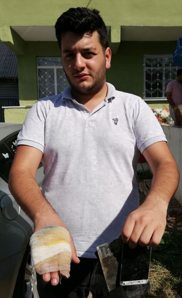 Patlayan cep telefonu yaraladı