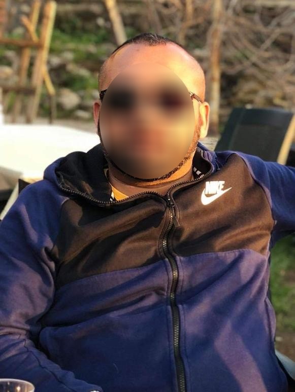 Çalışanını döverek öldüren patron yakalandı