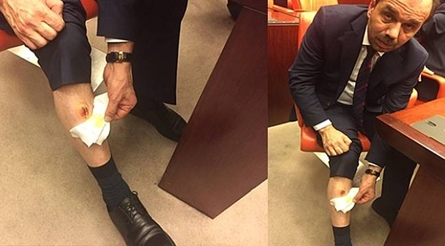 AK Parti'li Balta: Bacağımı CHP'li Vekil Isırdı