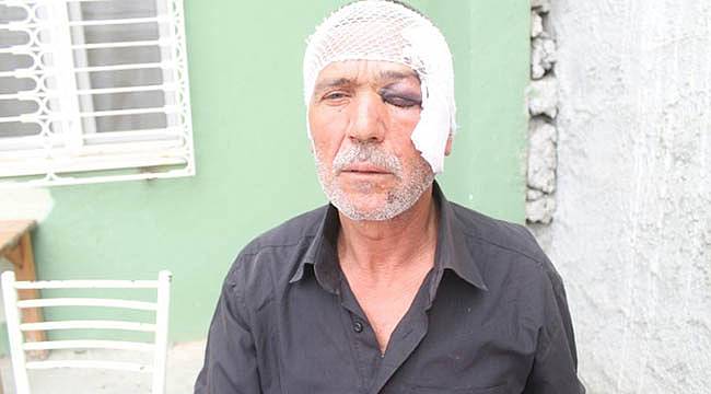 ‘Hayır’ Dediği İçin Saldırıya Maruz Kaldı!