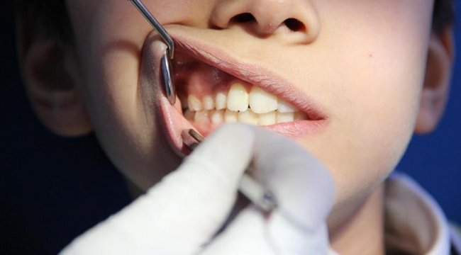 'Erken teşhis diş kurtarır'