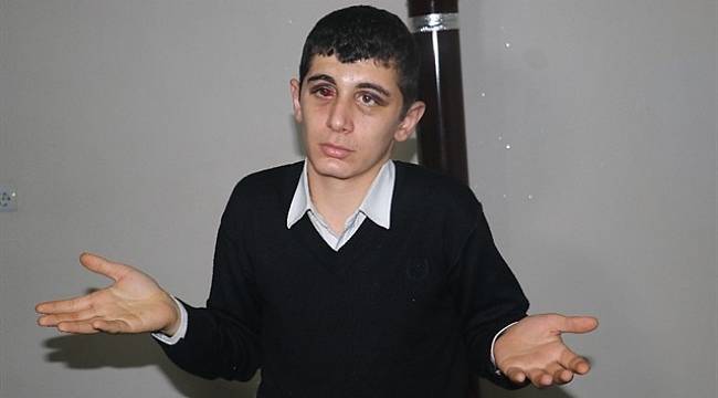 Adana'da 4 kişi, işitme engelli genci minibüste darp etti