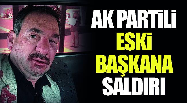 Ak Partili eski başkana saldırı