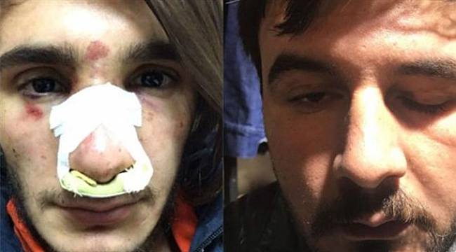 'Polisten gençlere uzun saç dayağı' iddiası: Bu saçınız başınız ne lan!