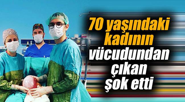 70 yaşındaki kadının vücudundan çıkan şok etti