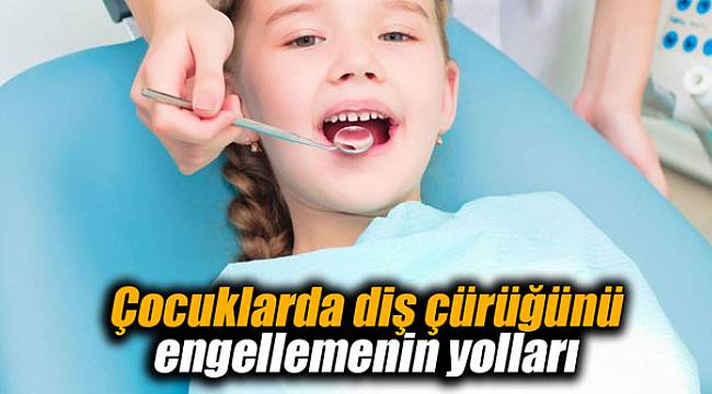 Çocuklarda diş çürüğünü engellemenin yolları