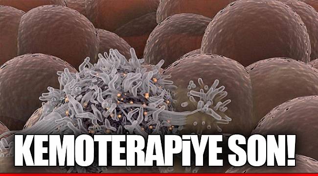 Kemoterapiye son!