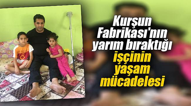Kurşun Fabrikası&#039;nın yarım bıraktığı işçinin yaşam mücadelesi